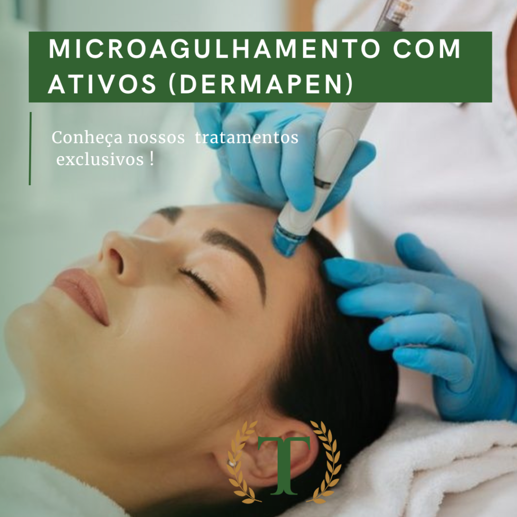 Microagulhamento Ativos Dermapen Thalles Diniz Odontologia