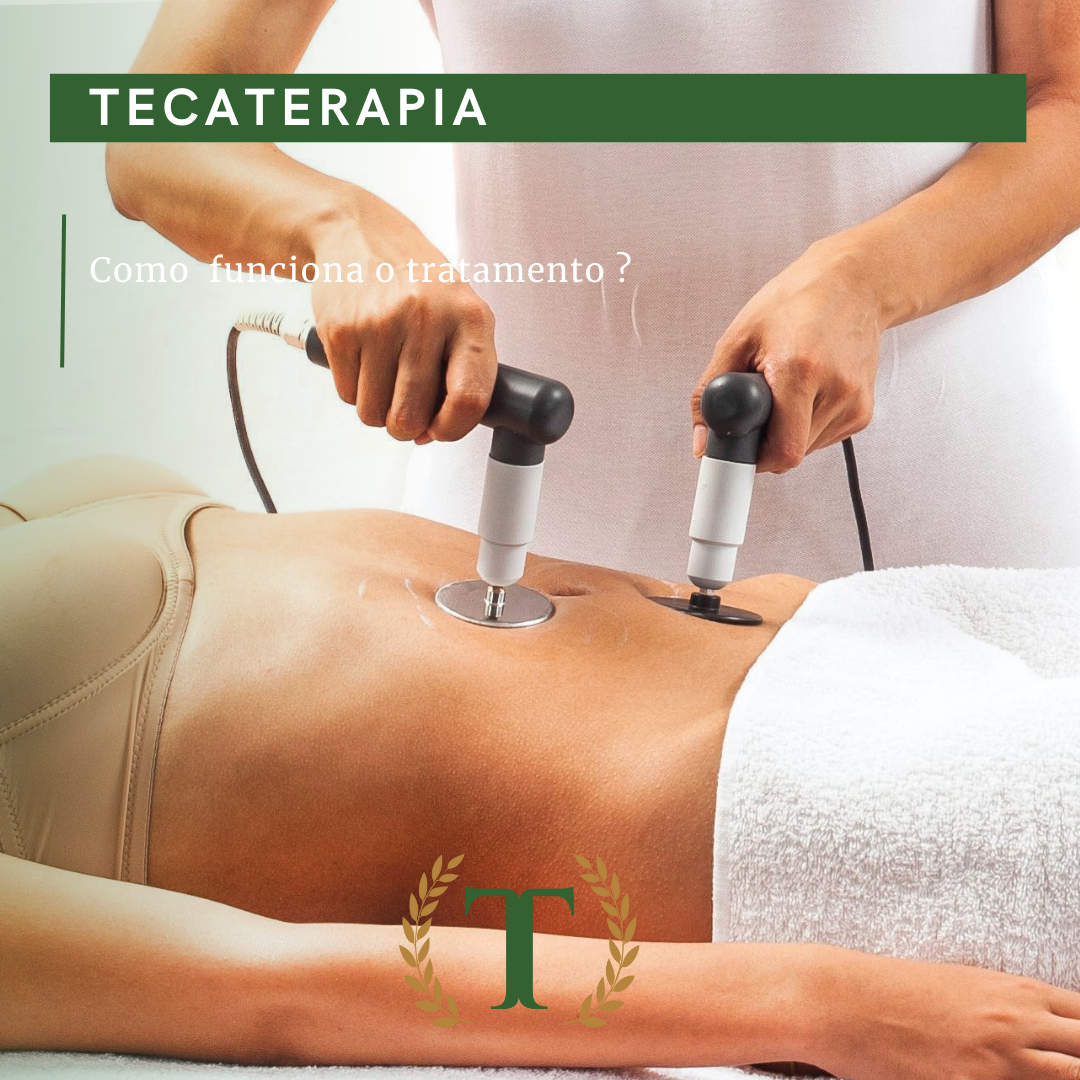 Tecaterapia Thalles Diniz Odontologia Estética e Saúde